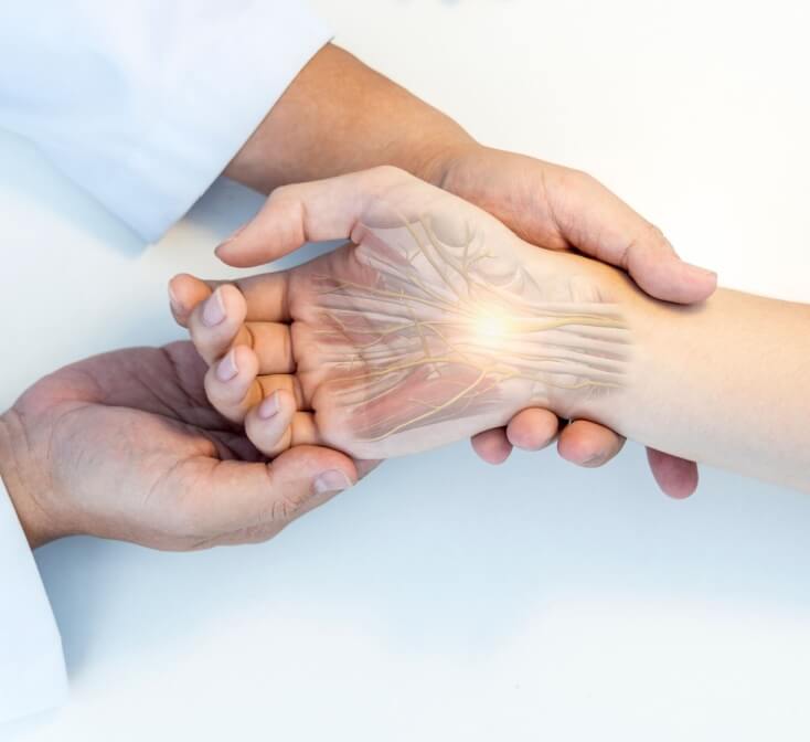 A medical professional examines a hand with graphics to show carpal tunnel - best call center in Tijuana.
